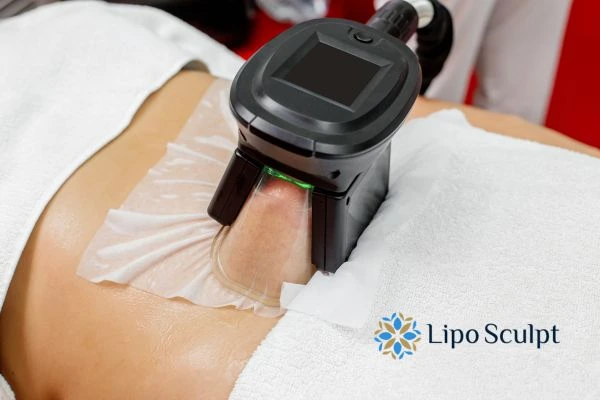 Does Fat Freezing at Home Work? DIY Devices vs Professional Cryolipolysis 1 How is professional cryolipolysis different Greater Manchester?
