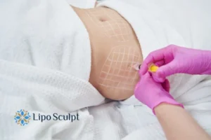 Are The Results From Aqualyx Permanent? 1 Do you want to know how long Aqualyx Greater Manchester results last?