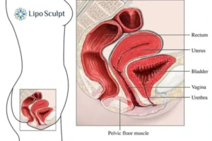 Treatment For A Leaky Bladder 2 How EM Chair treatment Greater Manchester can help Leaky bladder issues. Read more now!