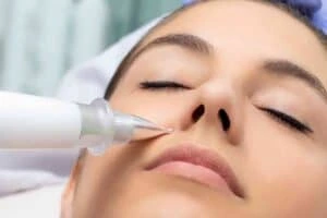 Best Actinic Keratoses Removal 3 Actinic keratoses Greater Manchester solutions - book in today!