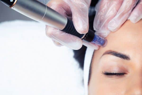 Explaining Total Skin Tightening Treatment and What to Expect 2 What Skin Concerns Can Total Skin Tightening Treatment Help With Greater Manchester?